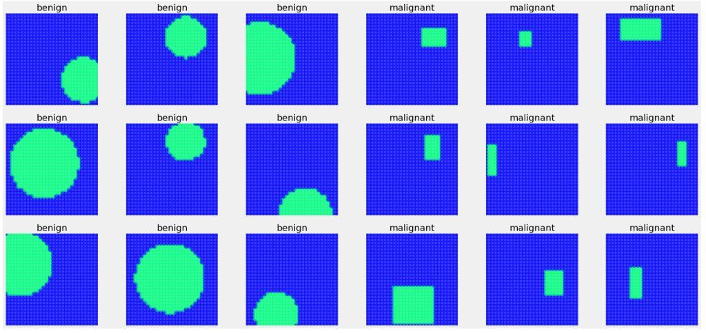 Tissue classification